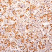Staining with Mouse Monclonal ACTH [Clone 57] Antibody in formalin-fixed paraffin-embedded human pituitary gland.